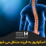 آیا-اسکولیوز-به-فرزند-منتقل-میشود